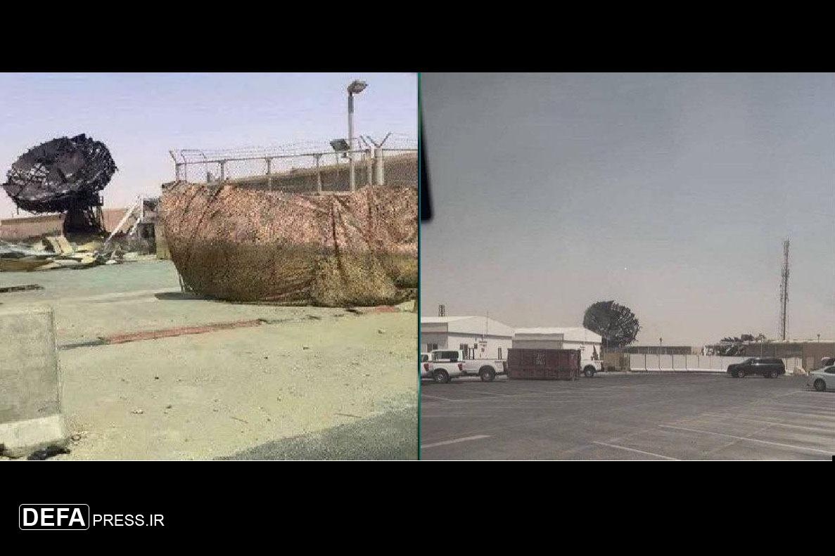 شلیک به چشم آمریکا